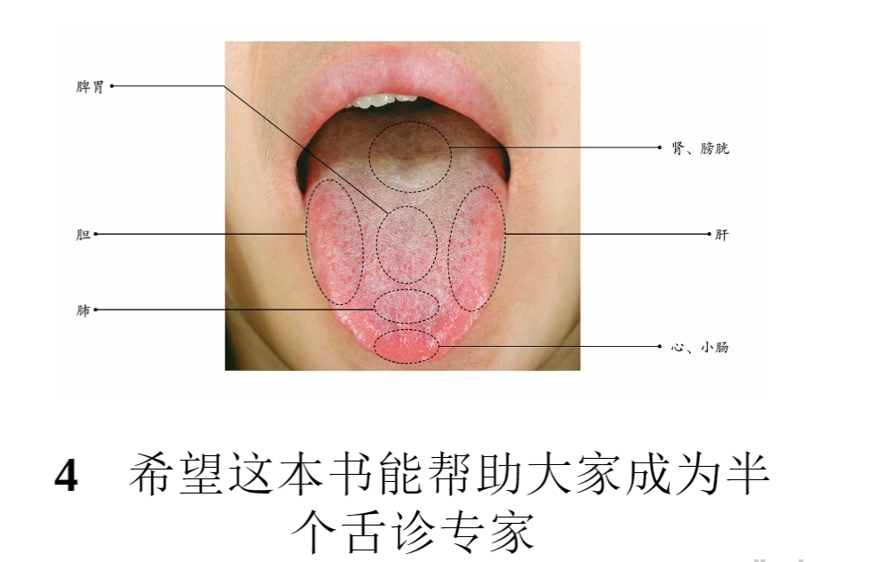 图解舌诊：伸伸舌头百病消(图2)